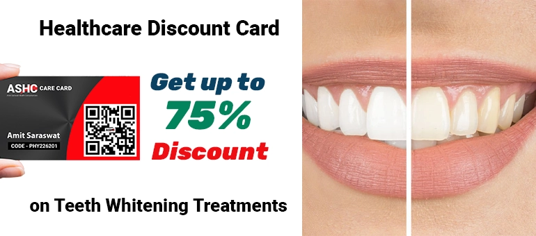 Discount on teeth whitening Treatments in Dubai